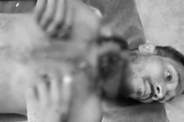 पलामूः शादी टूटने से बौखलाया युवक, पूर्व मंगेतर व उसके भाई पर चाकू से किया हमला