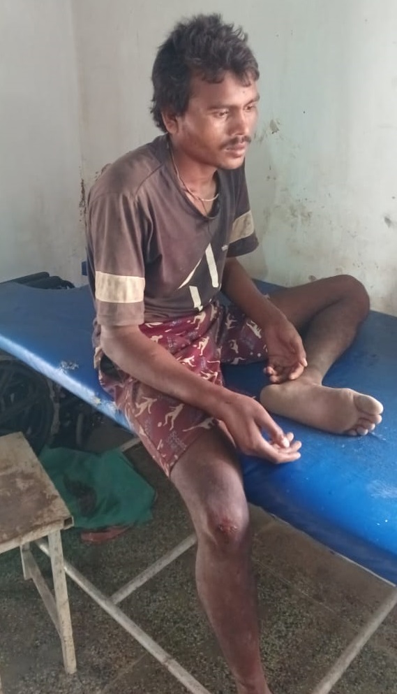 लातेहारः नशे में धुत युवक ने बुजुर्ग को टांगी से मारकर किया घायल, रिम्स रेफर