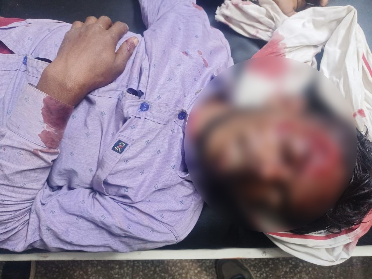 लातेहारः सड़क दुर्घटना में बाइक सवार युवक गंभीर रूप से घायल, रिम्सस रेफर