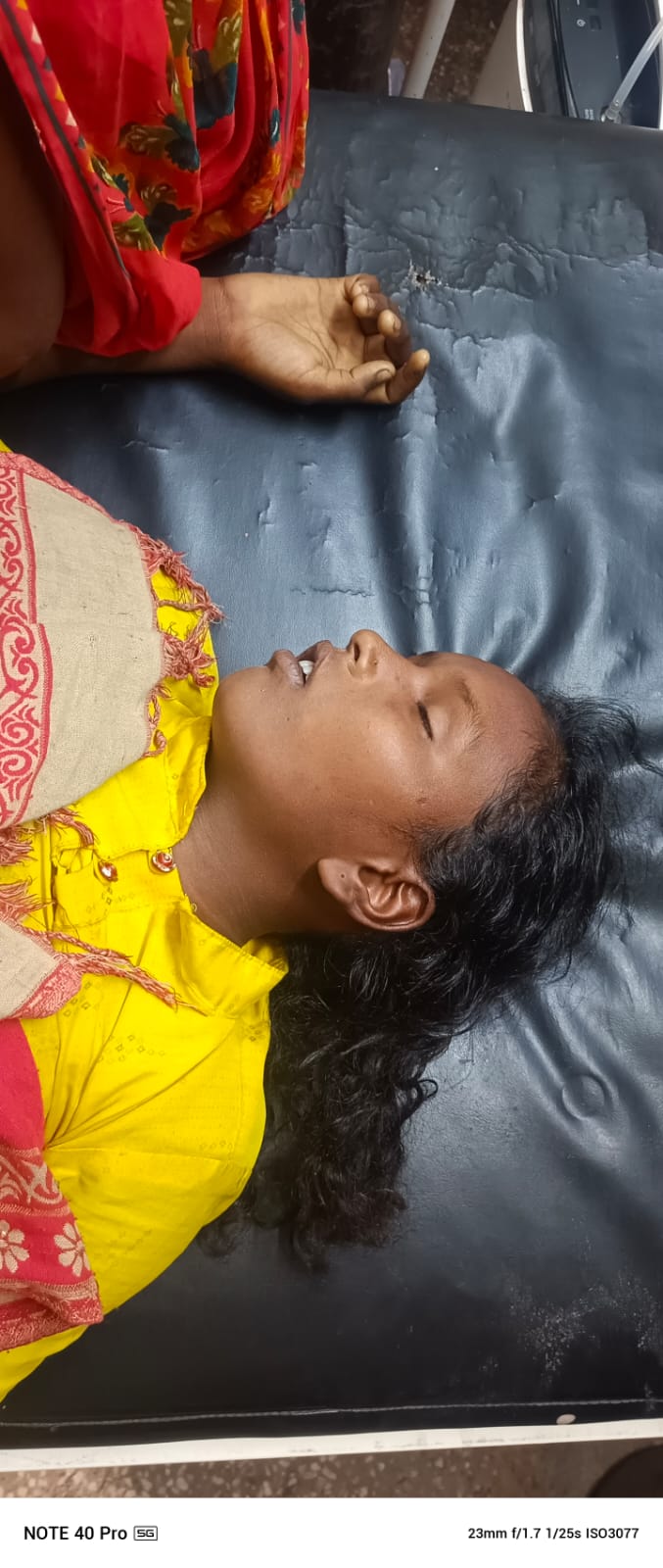 लातेहारः पैदल चल रही थी बच्ची, अचानक गिरी और हो गयी मौत