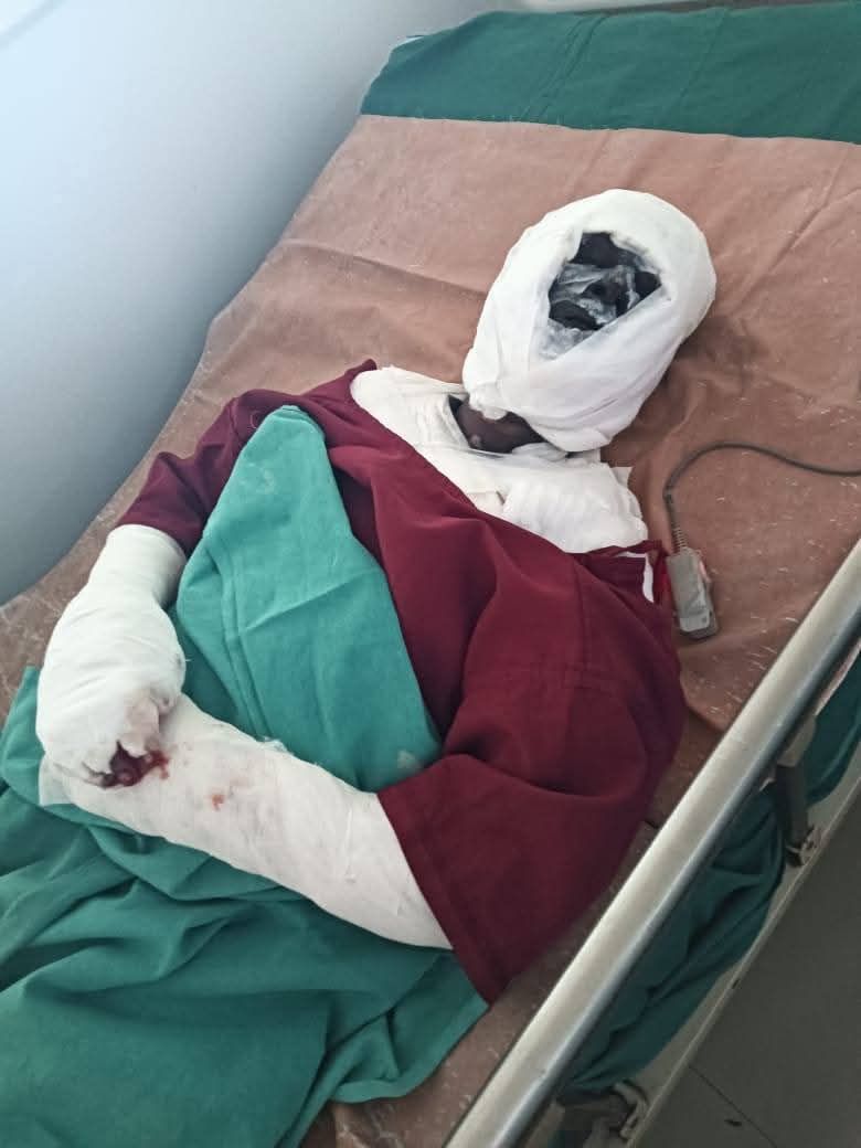 रामगढ़ः फैक्ट्री में विस्फोट में मृत व झुलसे मजदूरों को नहीं मिला मुआवजा, प्रशासन भी मौन