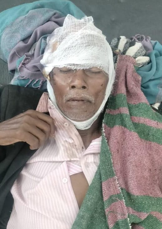 पलामूः ओझा-गुनी के शक में बुजुर्ग पर गड़ासा से हमला