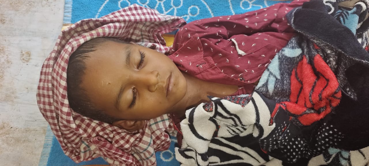 चाईबासाः आनंदपुर में सांप काटने से साढ़े तीन साल के बच्चे की मौत