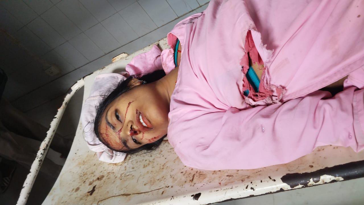 पलामूः ट्रक के धक्के से बीएड छात्रा की मौत, पति व बच्ची घायल