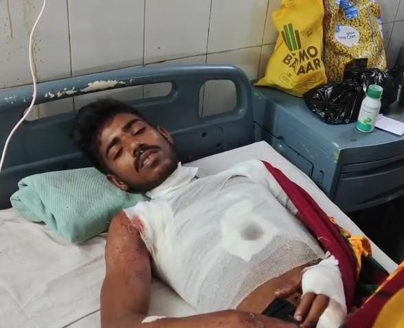 धनबादः उधारी लौटाने को कहा तो दोस्त ने चाकू से मारकर किया घायल