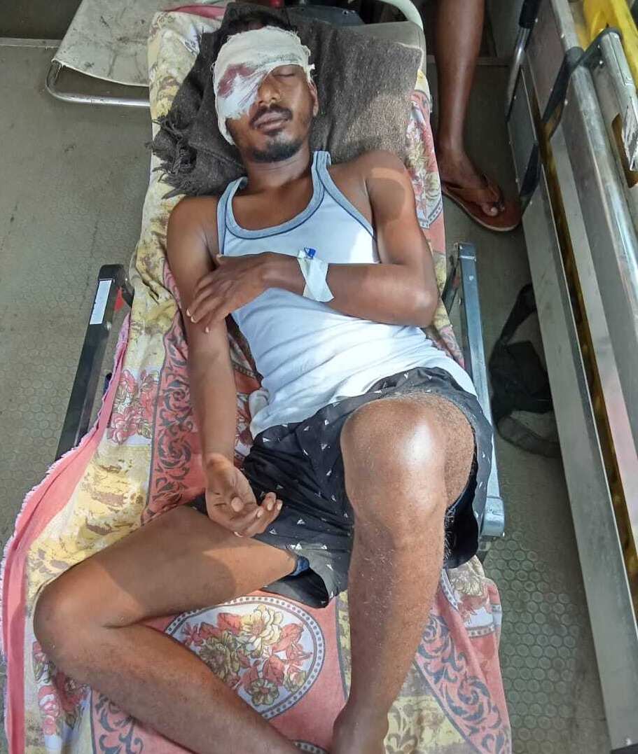 दुमकाः दो गुटों में  जमकर मारपीट, 2 युवक घायल, मामला प्रेम प्रसंग का