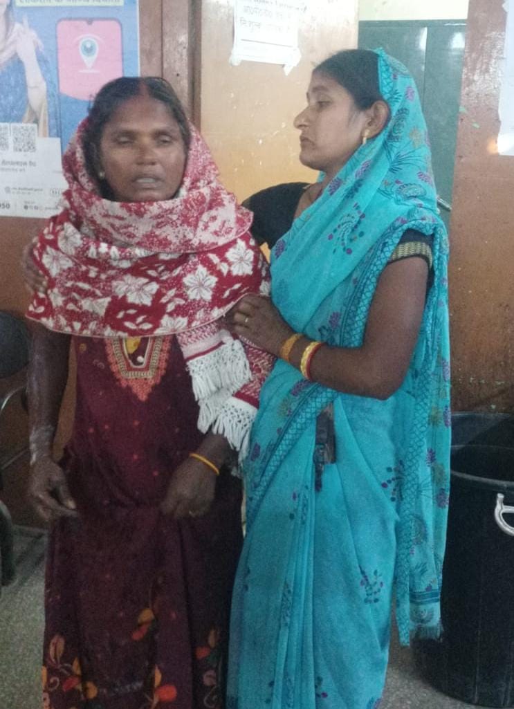 लातेहारः अलाव ताप रही महिला झुलसी, रिम्स रेफर