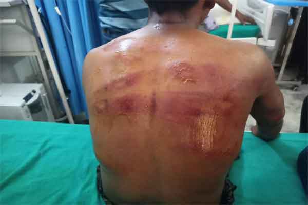 सिमडेगा: चर्च में पुरोहितों पर जानलेवा हमला, लाखों की लूट