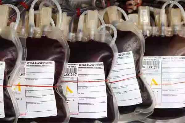 थैलेसीमिया बच्चों को HIV ब्लड देने वाले बैंक का लाइसेंस 2020 में ही हो गया था समाप्त