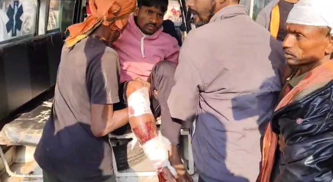 गिरिडीह :  जमुआ के पत्थर खदान में वर्चस्व को लेकर चली गोली, कई लोग घायल