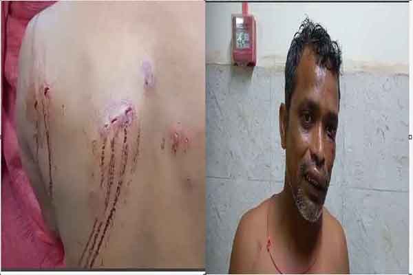 बोकारो :  झोला छाप डॉक्टर पर 200 रुपये के लिए मरीज पर कैंची से हमला करने का आरोप