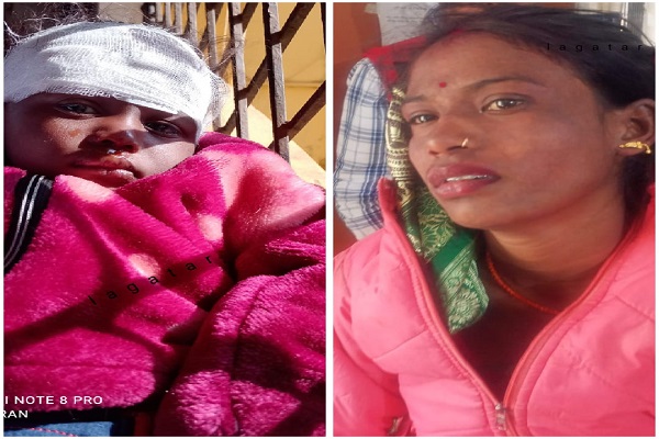 जमशेदपुर: अज्ञात वाहन की चपेट में आने से मां-बच्चा गंभीर रूप से घायल, बारीपदा रेफर