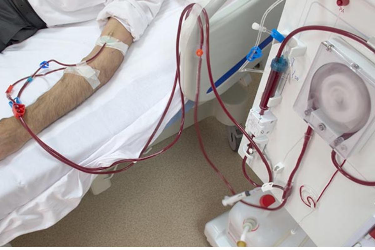 झारखंड के जिला व मेडिकल कॉलेज अस्पतालों में डायलिसिस सेवा को मिलेगी मजबूती, 4 करोड़ रुपये की राशि मंजूर