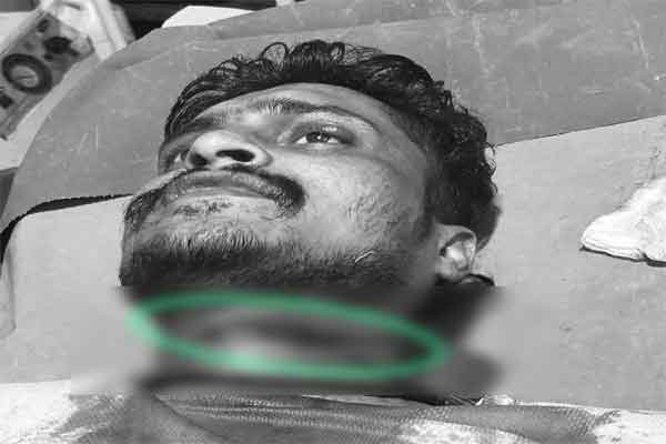 रांची के चुटिया में आपसी विवाद में युवक का गला काटा