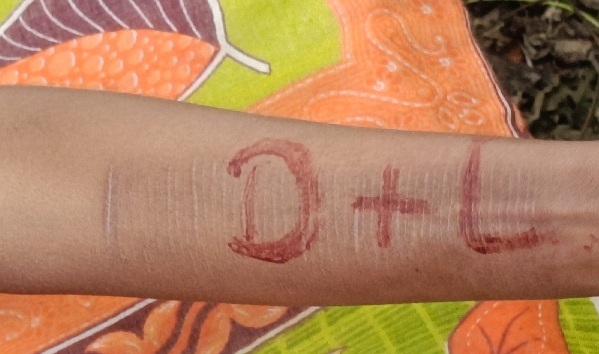 जमशेदपुर :  धालभूमगढ़ में नाबालिग लड़की का संदिग्ध परिस्थितियों में शव बरामद, हाथ पर D+L लिखा मिला