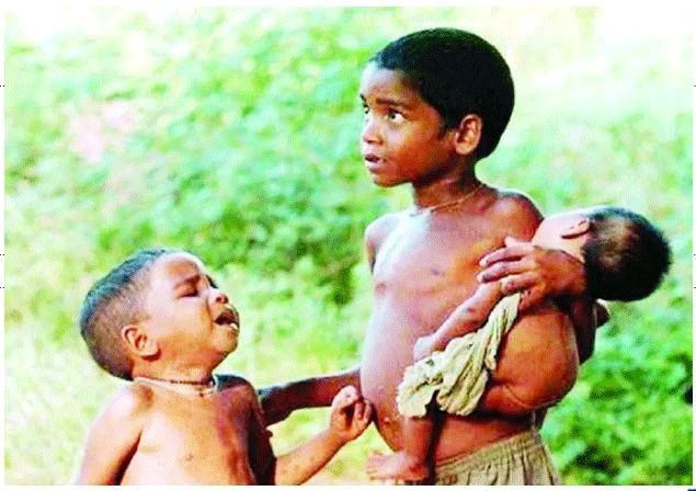 बच्चों को कुपोषण से बचाएं : अमेरिकी वैज्ञानिकों का रिसर्च