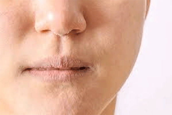 सर्दियों में ड्राई स्किन से हैं परेशान तो अपनाएं ये  उपाए