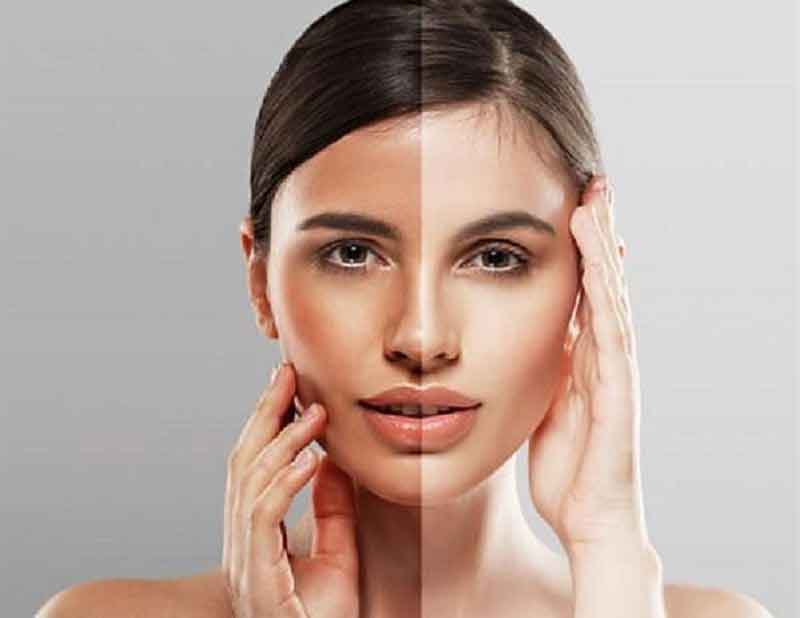 गर्मी में तेज़ धूप से त्वचा की रंगत फीकी पड़ जाती है, जानिए टैनिंग हटाने के घरेलू उपाय